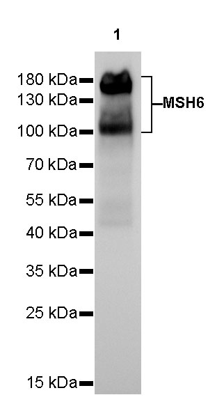 Rabbit anti-MSH6 Recombinant Monoclonal Antibody(R094)