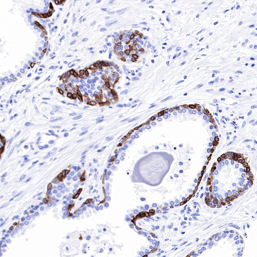 Rabbit anti-Keratin 17 Recombinant Monoclonal Antibody(011-43)