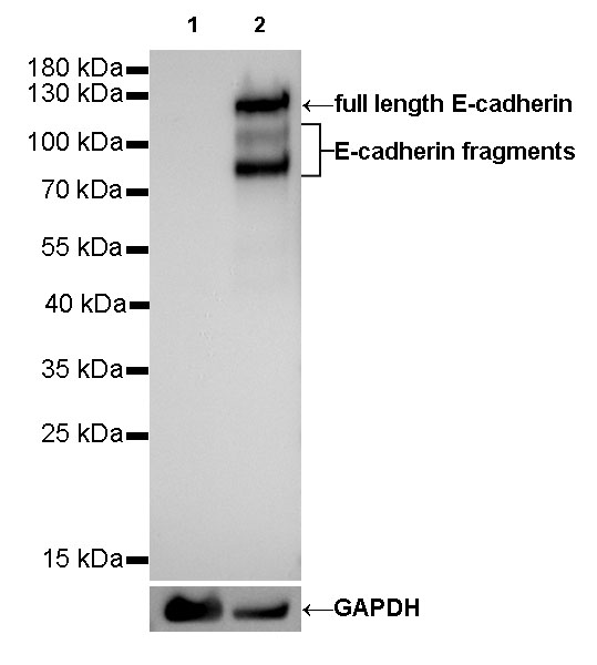 Rabbit anti-E-Cadherin Recombinant Monoclonal Antibody(R088)