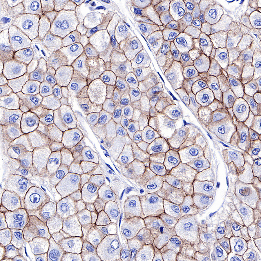 Rabbit anti-E-Cadherin Recombinant Monoclonal Antibody(R088)