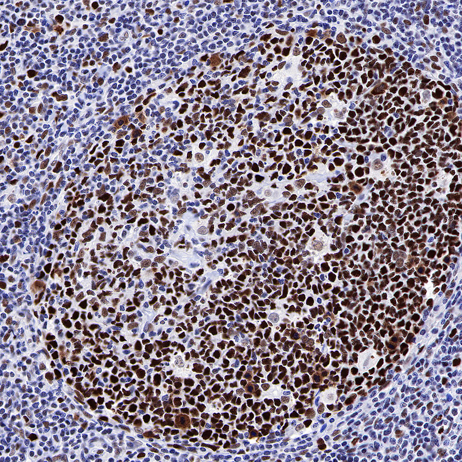 Rabbit anti-MSH6 Recombinant Monoclonal Antibody(R094)