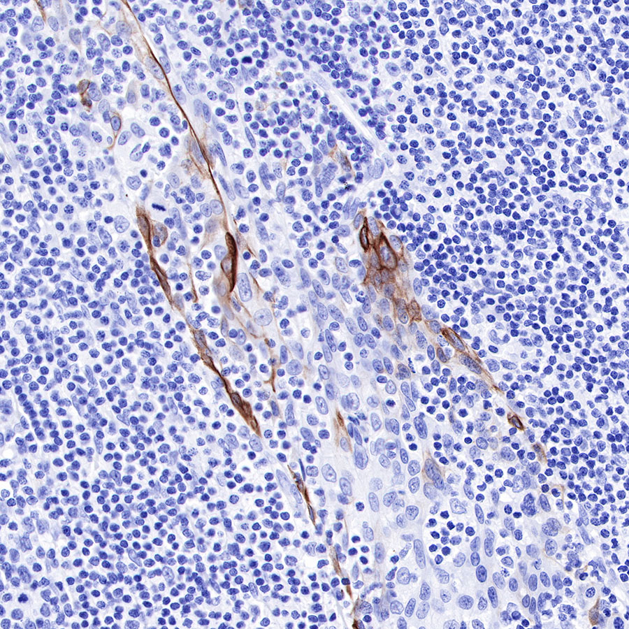 Rabbit anti-Keratin 17 Recombinant Monoclonal Antibody(011-43)