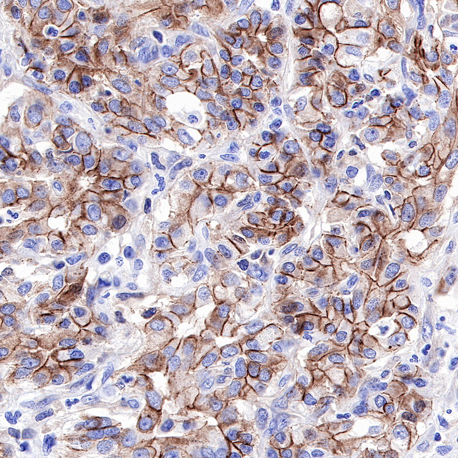 Rabbit anti-E-Cadherin Recombinant Monoclonal Antibody(R088)