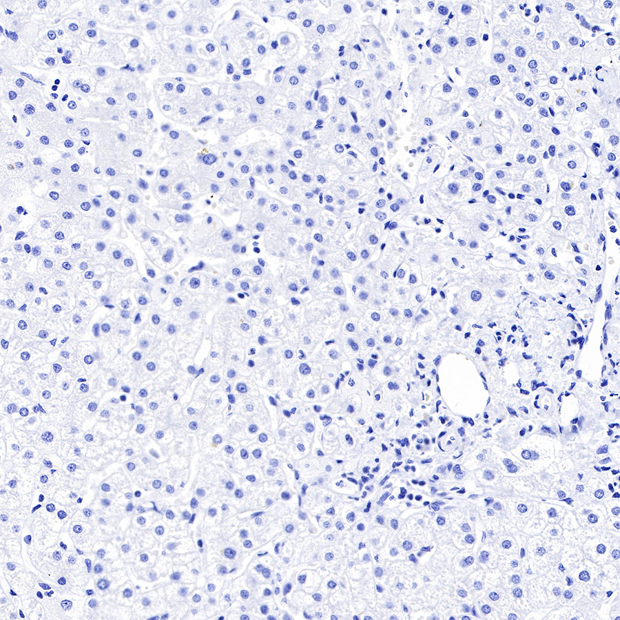 Rabbit anti-DLL3 Recombinant Monoclonal Antibody(207-59)