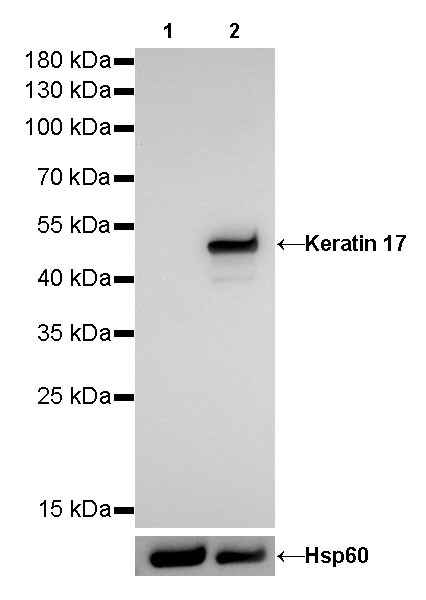 Rabbit anti-Keratin 17 Recombinant Monoclonal Antibody(011-43)