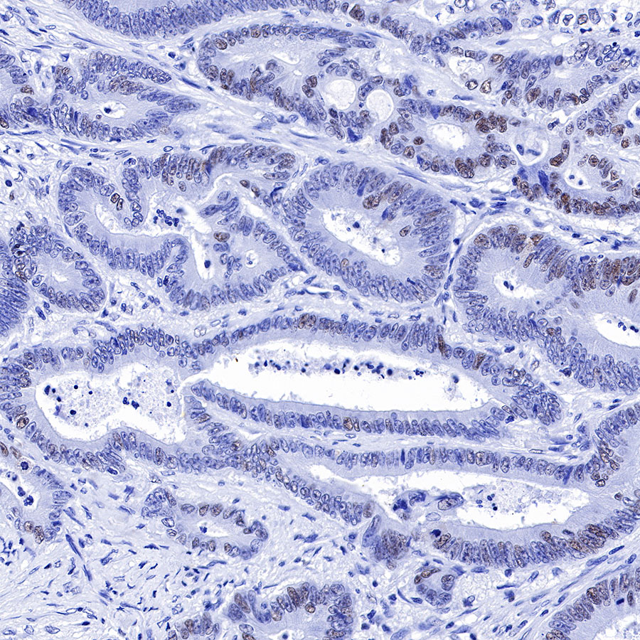 Rabbit anti-MSH6 Recombinant Monoclonal Antibody(R094)