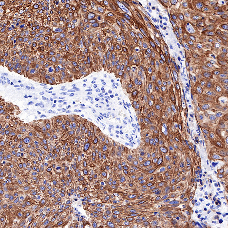 Rabbit anti-Keratin 17 Recombinant Monoclonal Antibody(011-43)