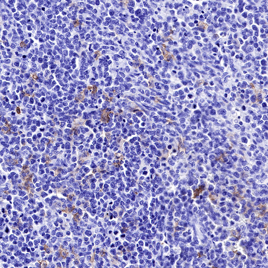 Rabbit anti-CD16a Recombinant Monoclonal Antibody(R099)