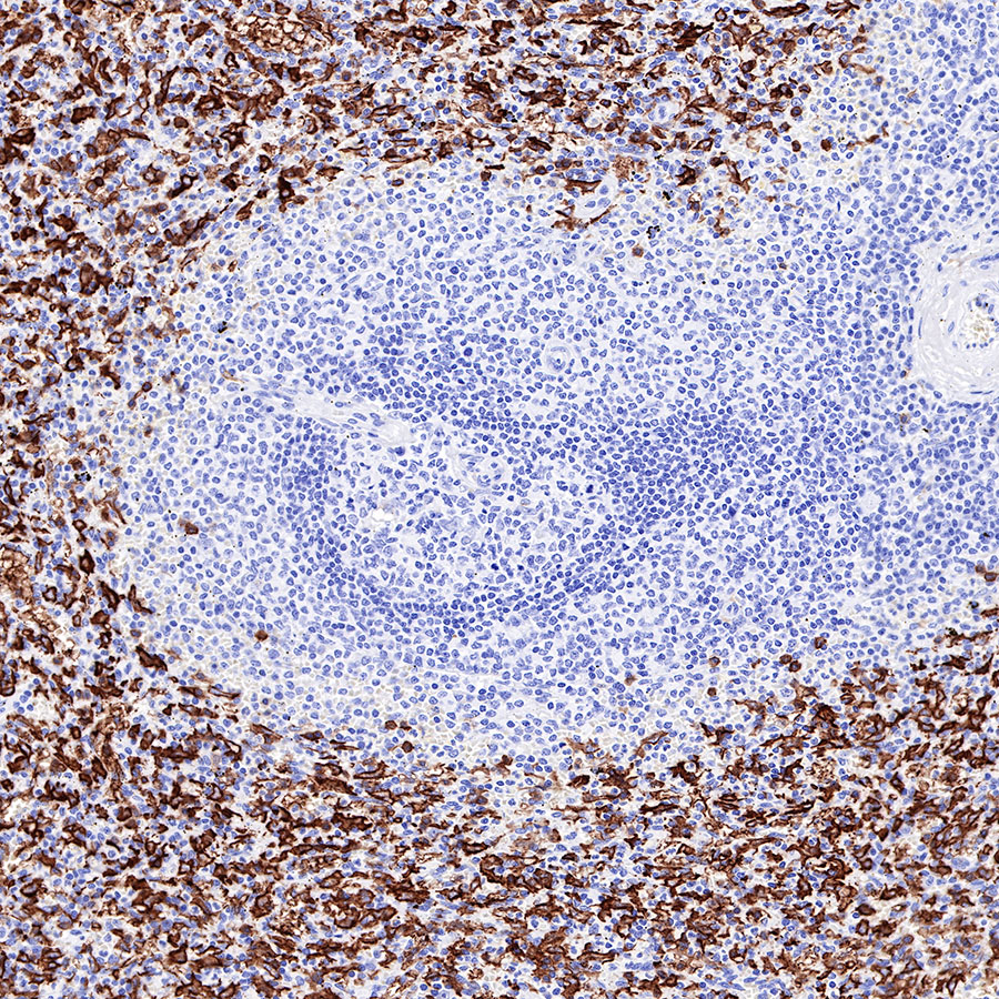 Rabbit anti-CD16a Recombinant Monoclonal Antibody(R099)