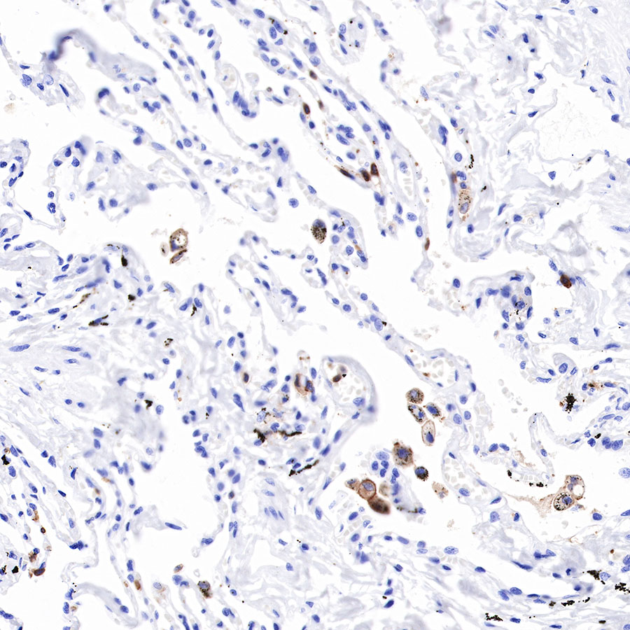 Rabbit anti-CD16a Recombinant Monoclonal Antibody(R099)