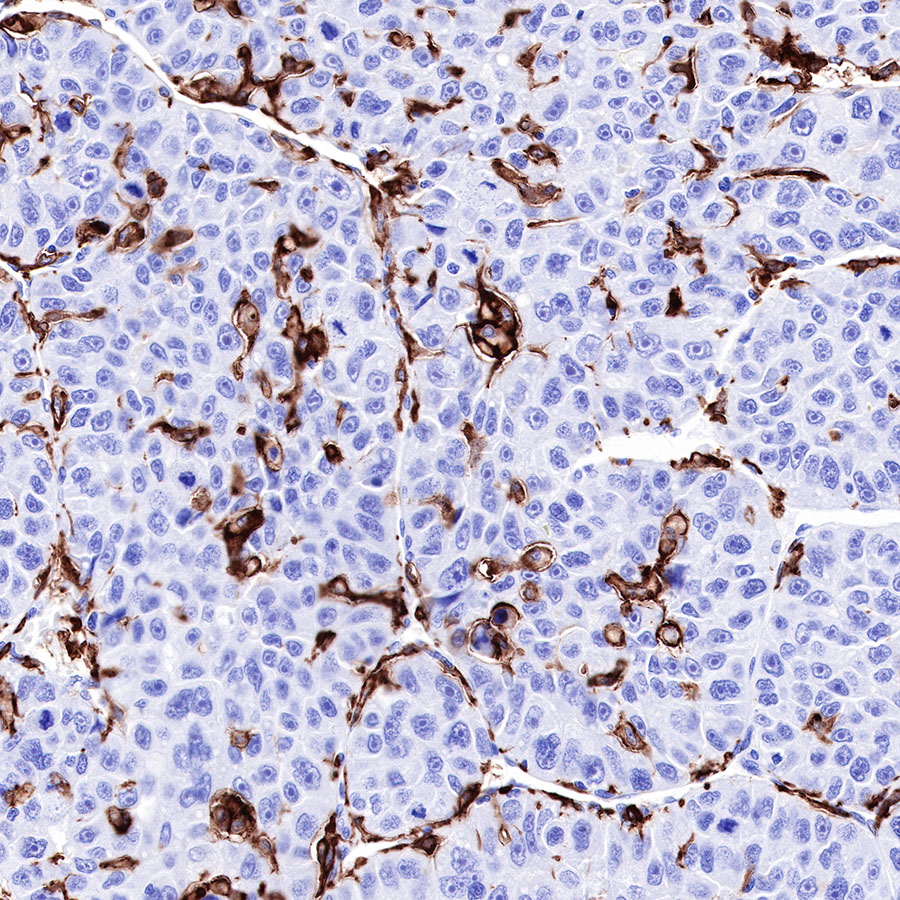 Rabbit anti-CD16a Recombinant Monoclonal Antibody(R099)