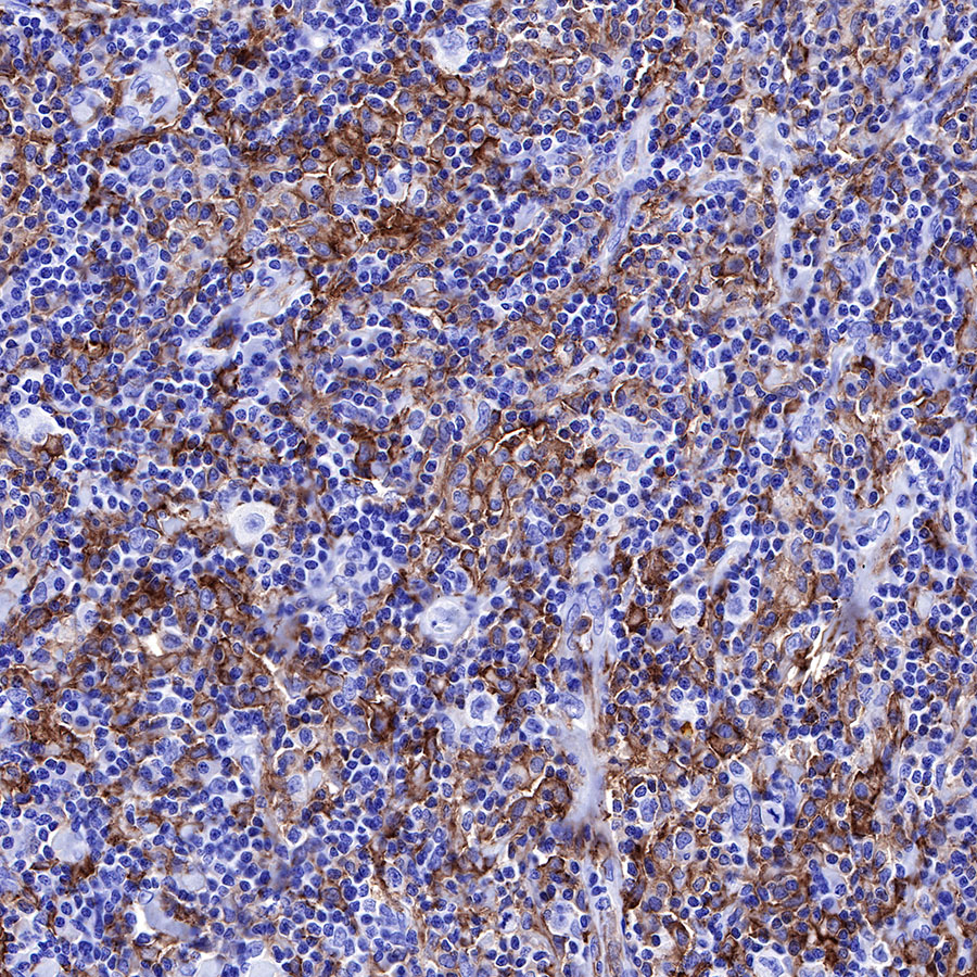 Rabbit anti-CD16a Recombinant Monoclonal Antibody(R099)