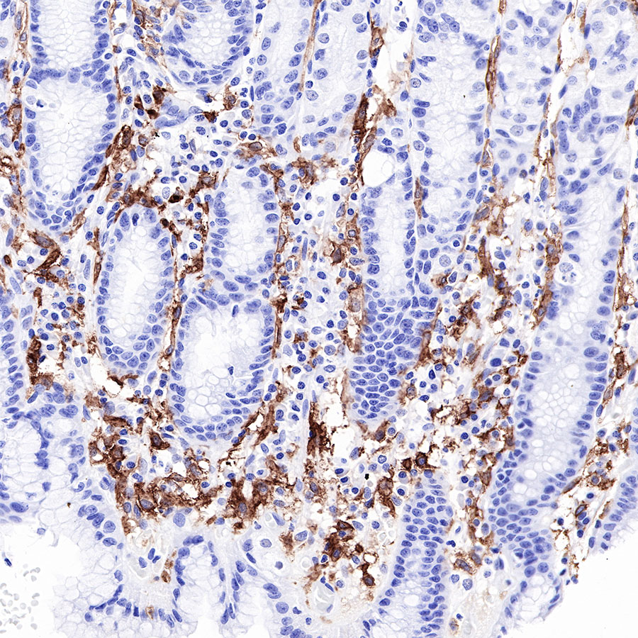 Rabbit anti-CD16a Recombinant Monoclonal Antibody(R099)