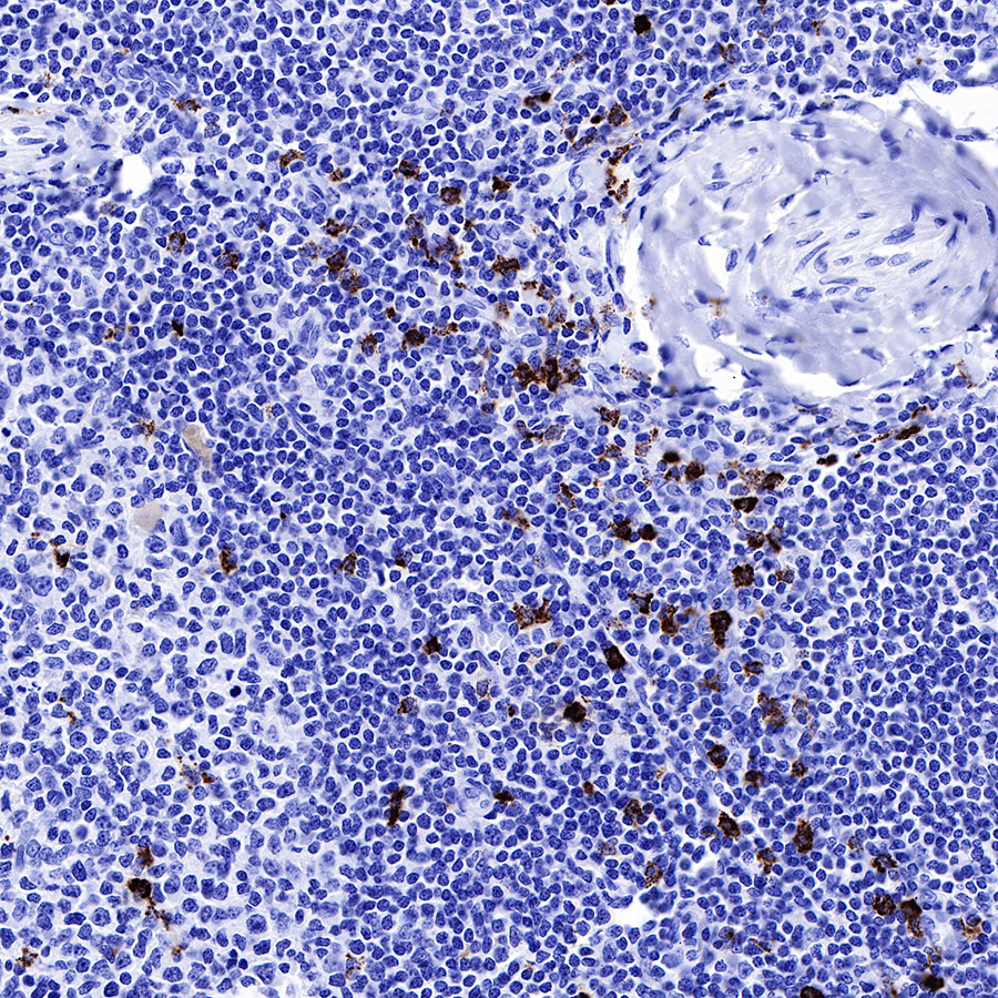 Rabbit anti-MPO Recombinant Monoclonal Antibody(224-19)
