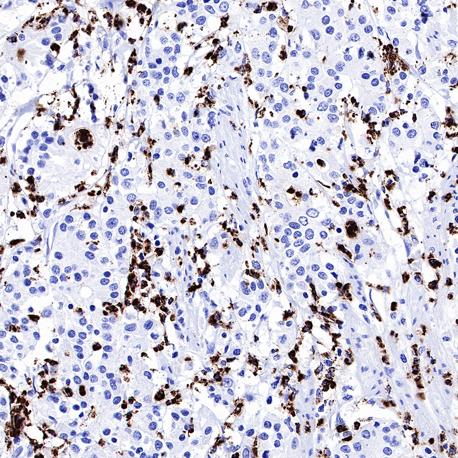 Rabbit anti-MPO Recombinant Monoclonal Antibody(224-19)