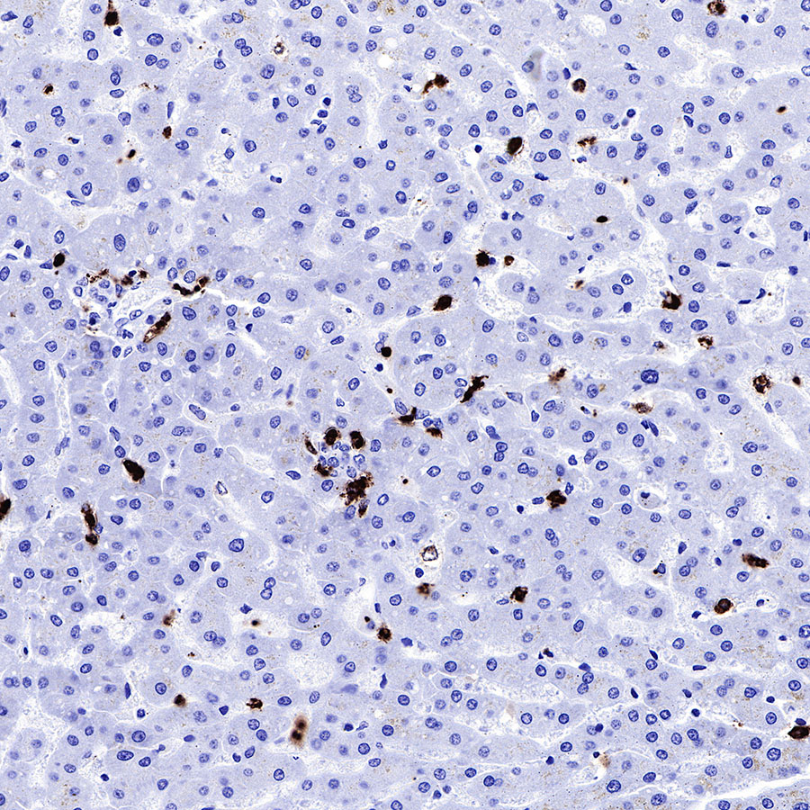 Rabbit anti-MPO Recombinant Monoclonal Antibody(224-19)