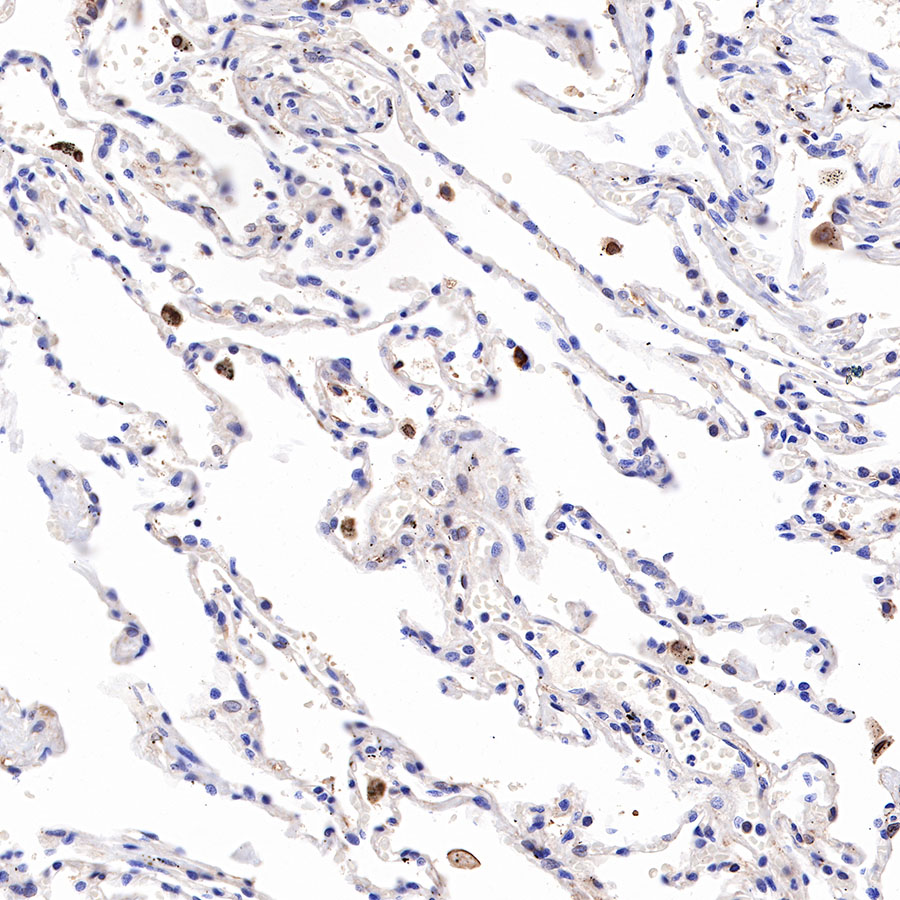 Rabbit anti-IL-10 Recombinant Monoclonal Antibody(088-83)
