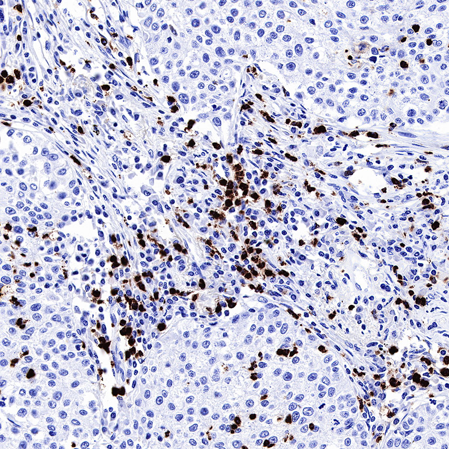 Rabbit anti-MPO Recombinant Monoclonal Antibody(224-19)