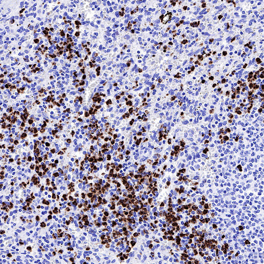 Rabbit anti-MPO Recombinant Monoclonal Antibody(224-19)