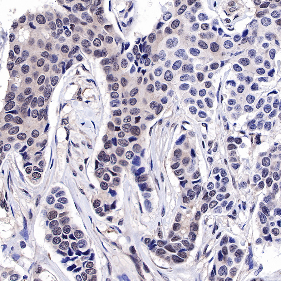 Rabbit anti-SMAD4 Recombinant Monoclonal Antibody(R114)