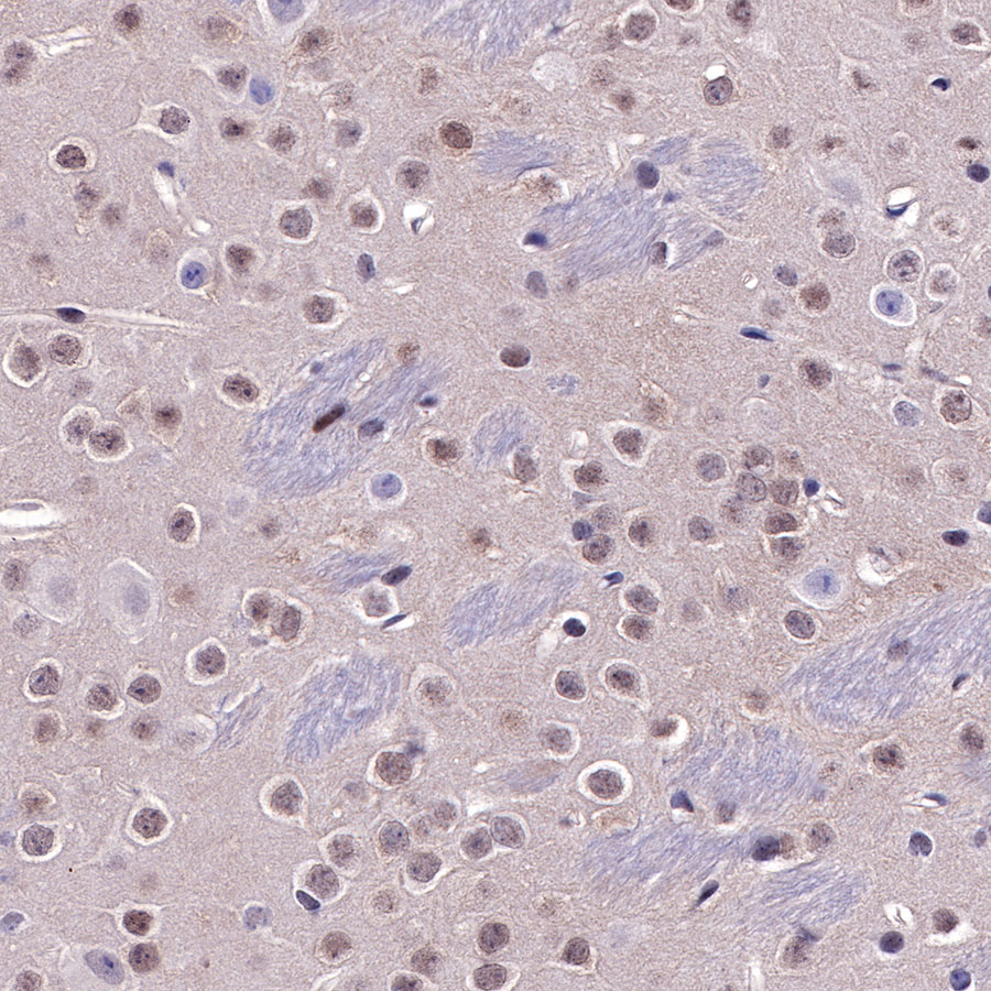 Rabbit anti-SMAD4 Recombinant Monoclonal Antibody(R114)