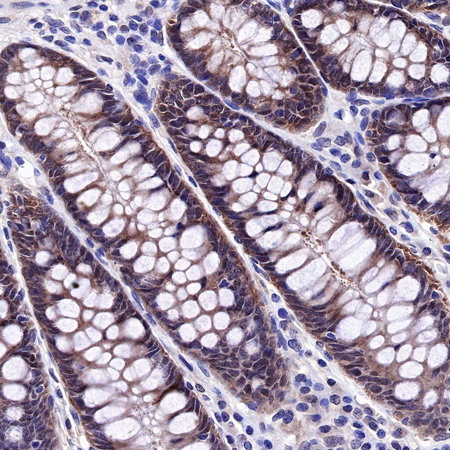 Rabbit anti-SMAD4 Recombinant Monoclonal Antibody(R114)