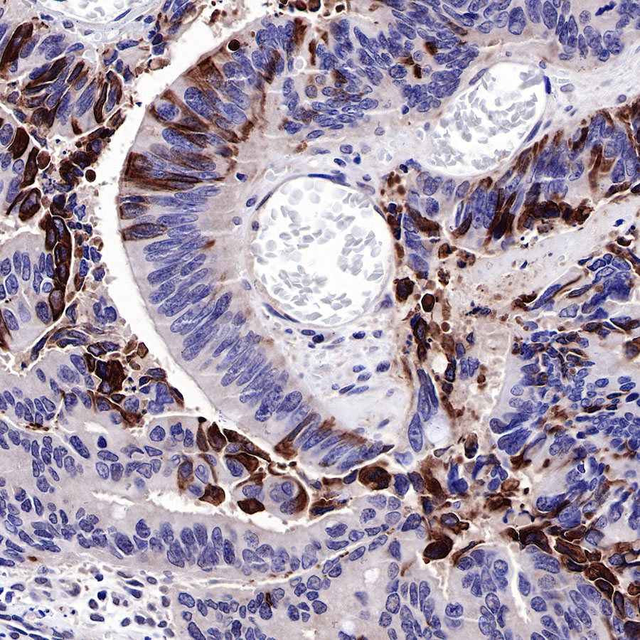 Rabbit anti-SMAD4 Recombinant Monoclonal Antibody(R114)
