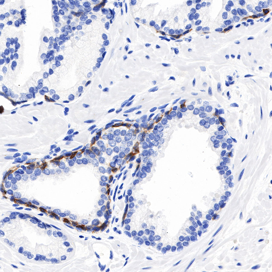 Rabbit anti-CK5/6 Recombinant Monoclonal Antibody(P004)