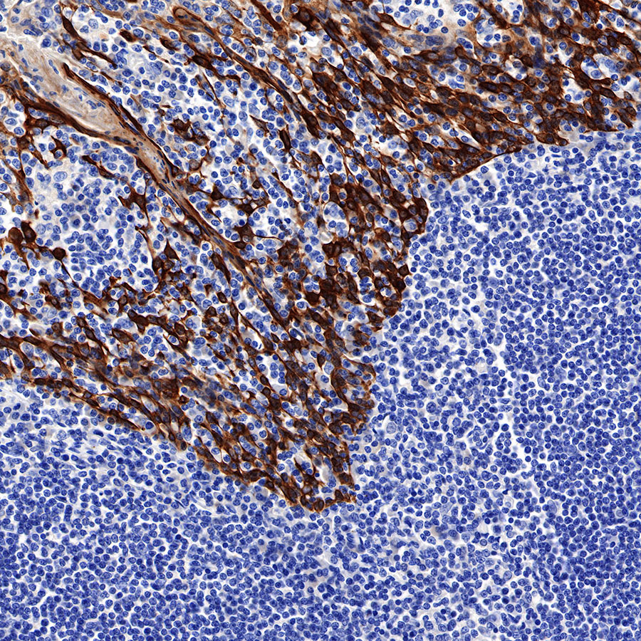 Rabbit anti-CK5/6 Recombinant Monoclonal Antibody(P004)
