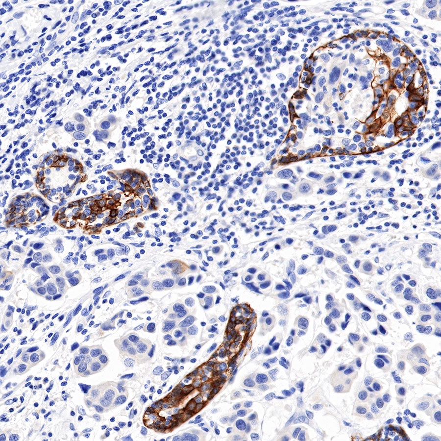 Rabbit anti-CK5/6 Recombinant Monoclonal Antibody(P004)