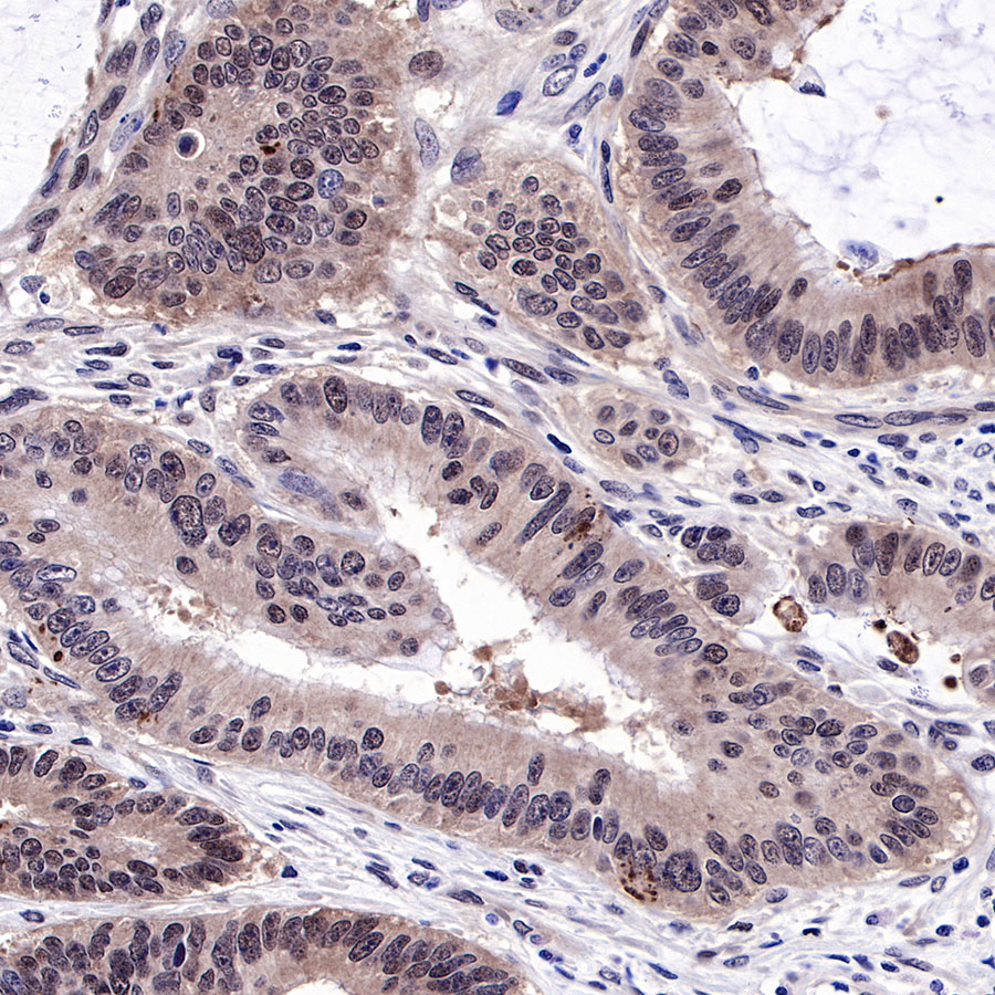 Rabbit anti-SMAD4 Recombinant Monoclonal Antibody(R114)