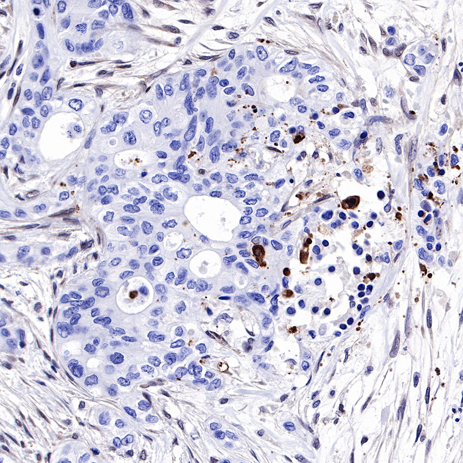 Rabbit anti-SMAD4 Recombinant Monoclonal Antibody(R114)