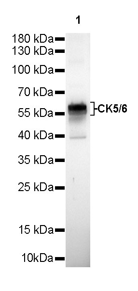 Rabbit anti-CK5/6 Recombinant Monoclonal Antibody(P004)