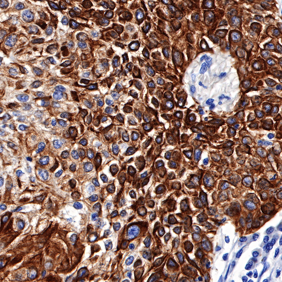 Rabbit anti-CK5/6 Recombinant Monoclonal Antibody(P004)