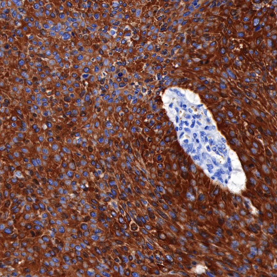 Rabbit anti-CK5/6 Recombinant Monoclonal Antibody(P004)