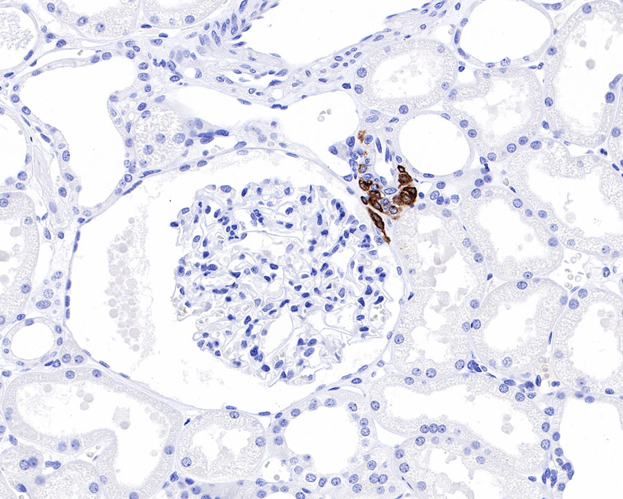 Rabbit anti-Renin Recombinant Monoclonal Antibody(087-48)