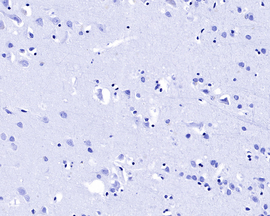 Rabbit anti-Renin Recombinant Monoclonal Antibody(087-48)