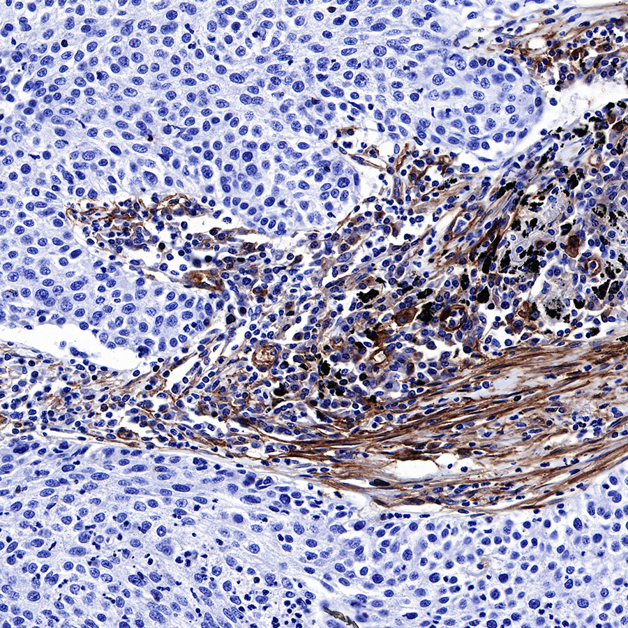 Rabbit anti-CD39 Recombinant Monoclonal Antibody(236-20)