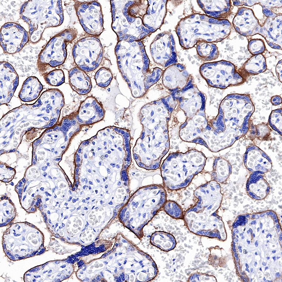 Rabbit anti-CD39 Recombinant Monoclonal Antibody(236-20)