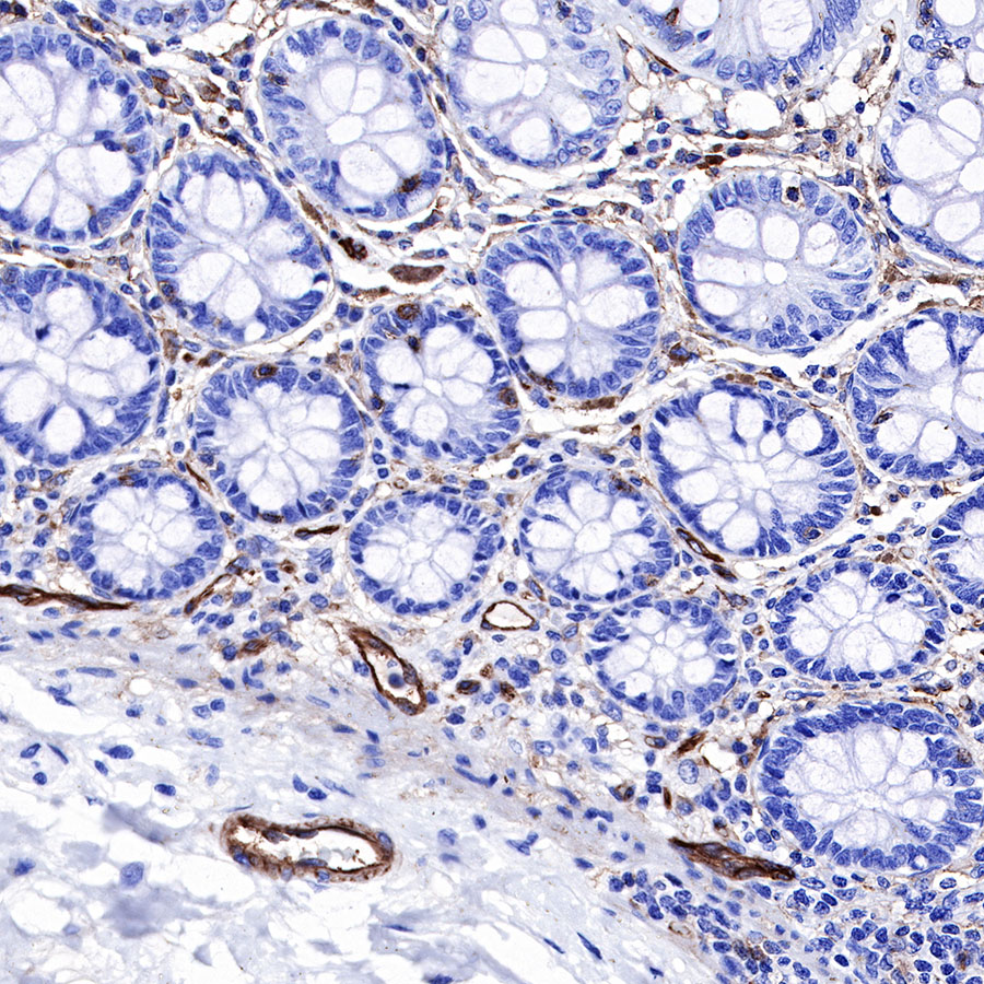 Rabbit anti-CD39 Recombinant Monoclonal Antibody(236-20)
