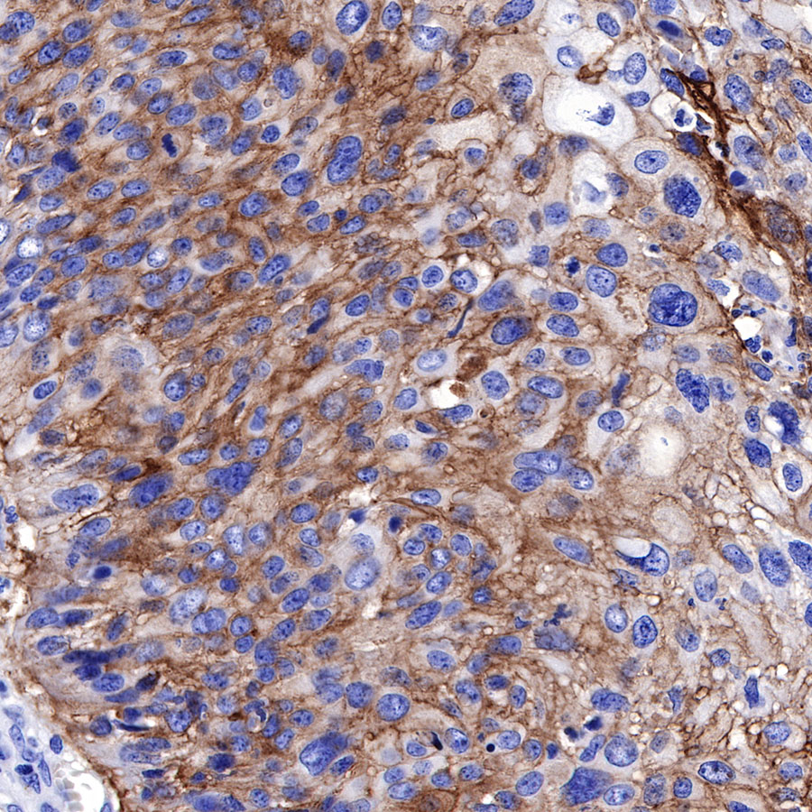 Rabbit anti-Thrombomodulin Recombinant Monoclonal Antibody(153-89)