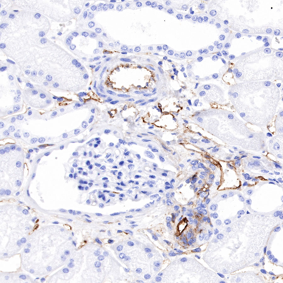 Rabbit anti-Thrombomodulin Recombinant Monoclonal Antibody(153-89)