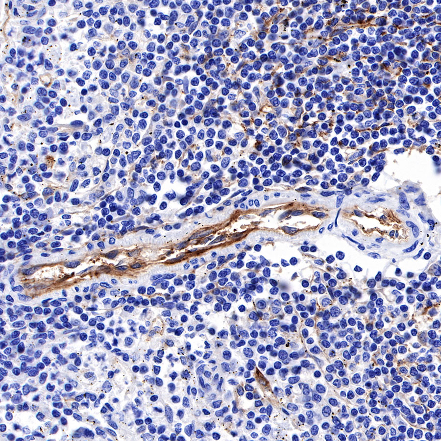 Rabbit anti-Thrombomodulin Recombinant Monoclonal Antibody(153-89)