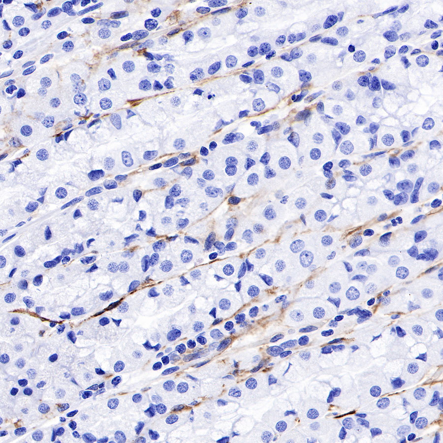Rabbit anti-Thrombomodulin Recombinant Monoclonal Antibody(153-89)