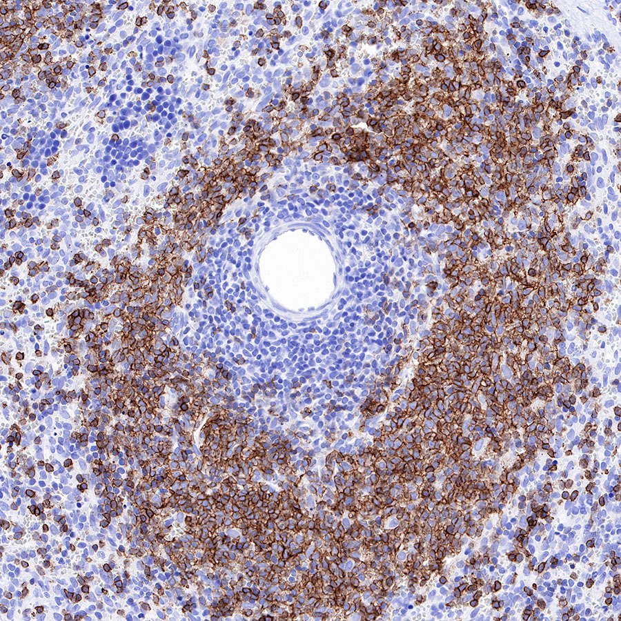 Rabbit anti-CD20 Recombinant Monoclonal Antibody(R133)