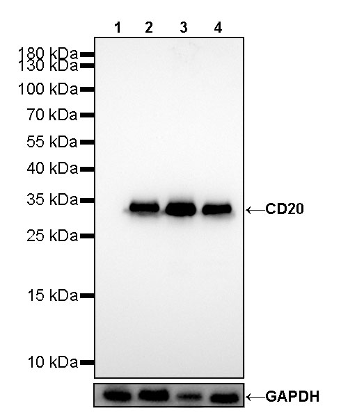 Rabbit anti-CD20 Recombinant Monoclonal Antibody(R133)
