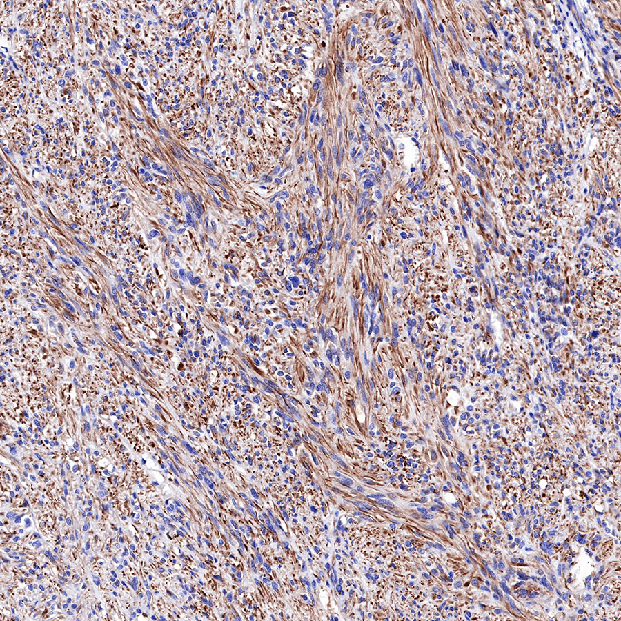 Rabbit anti-Nestin Recombinant Monoclonal Antibody(R112)