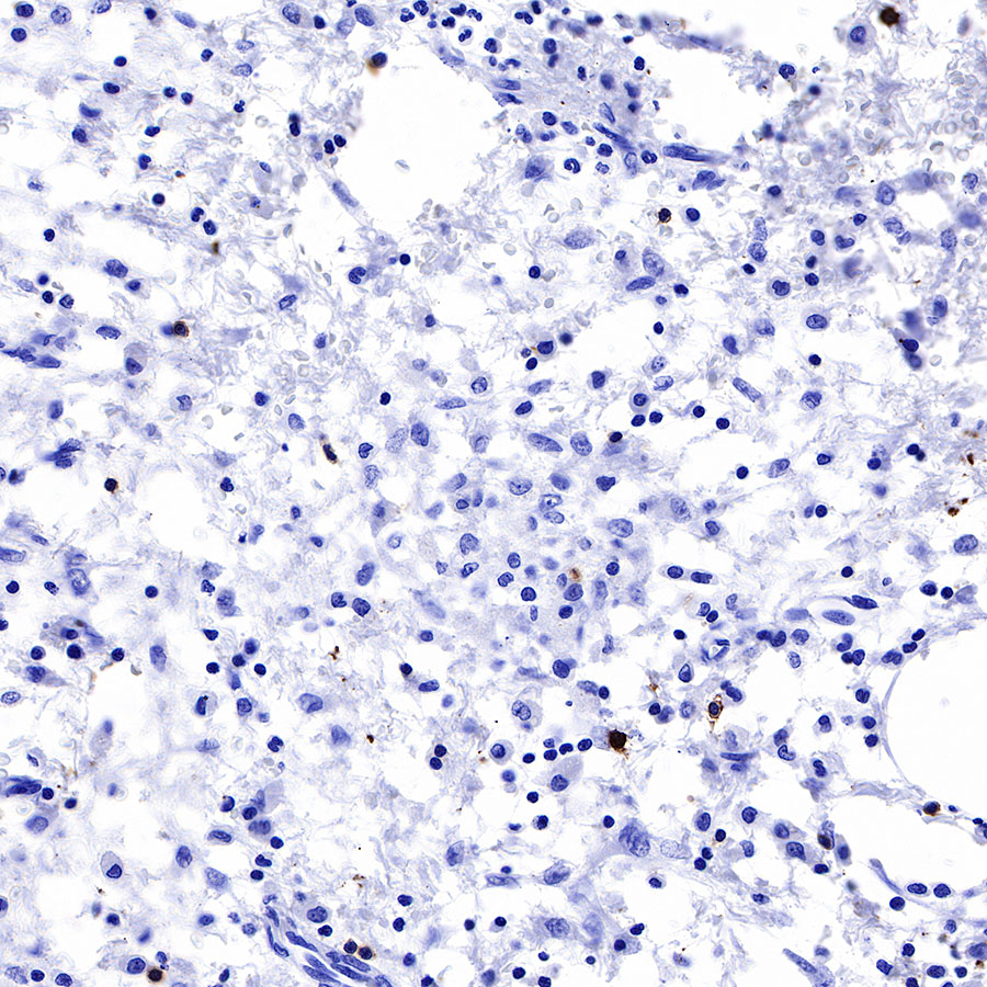 Rabbit anti-CD20 Recombinant Monoclonal Antibody(R133)