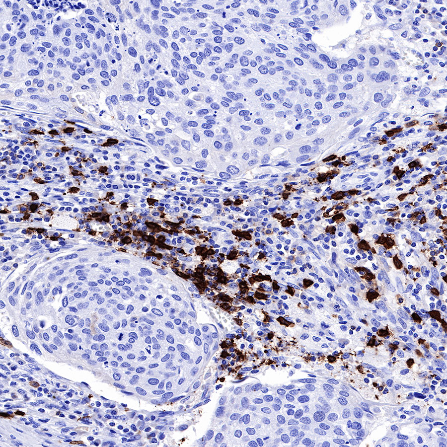 Rabbit anti-CD20 Recombinant Monoclonal Antibody(R133)