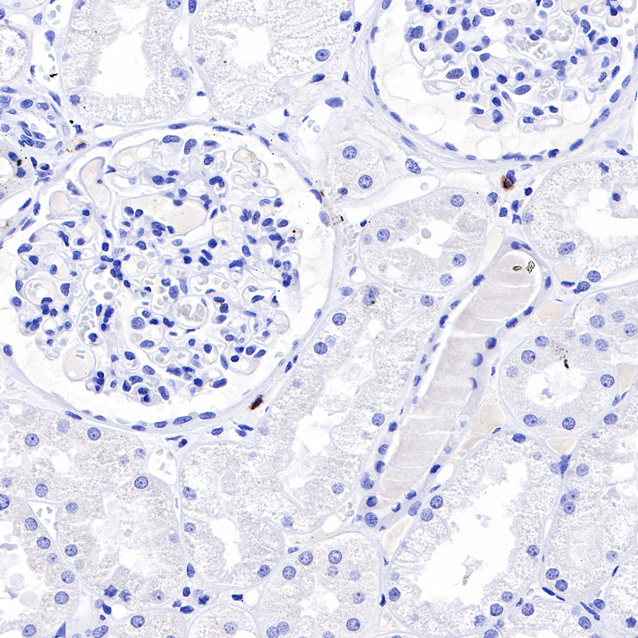 Rabbit anti-CD20 Recombinant Monoclonal Antibody(R133)